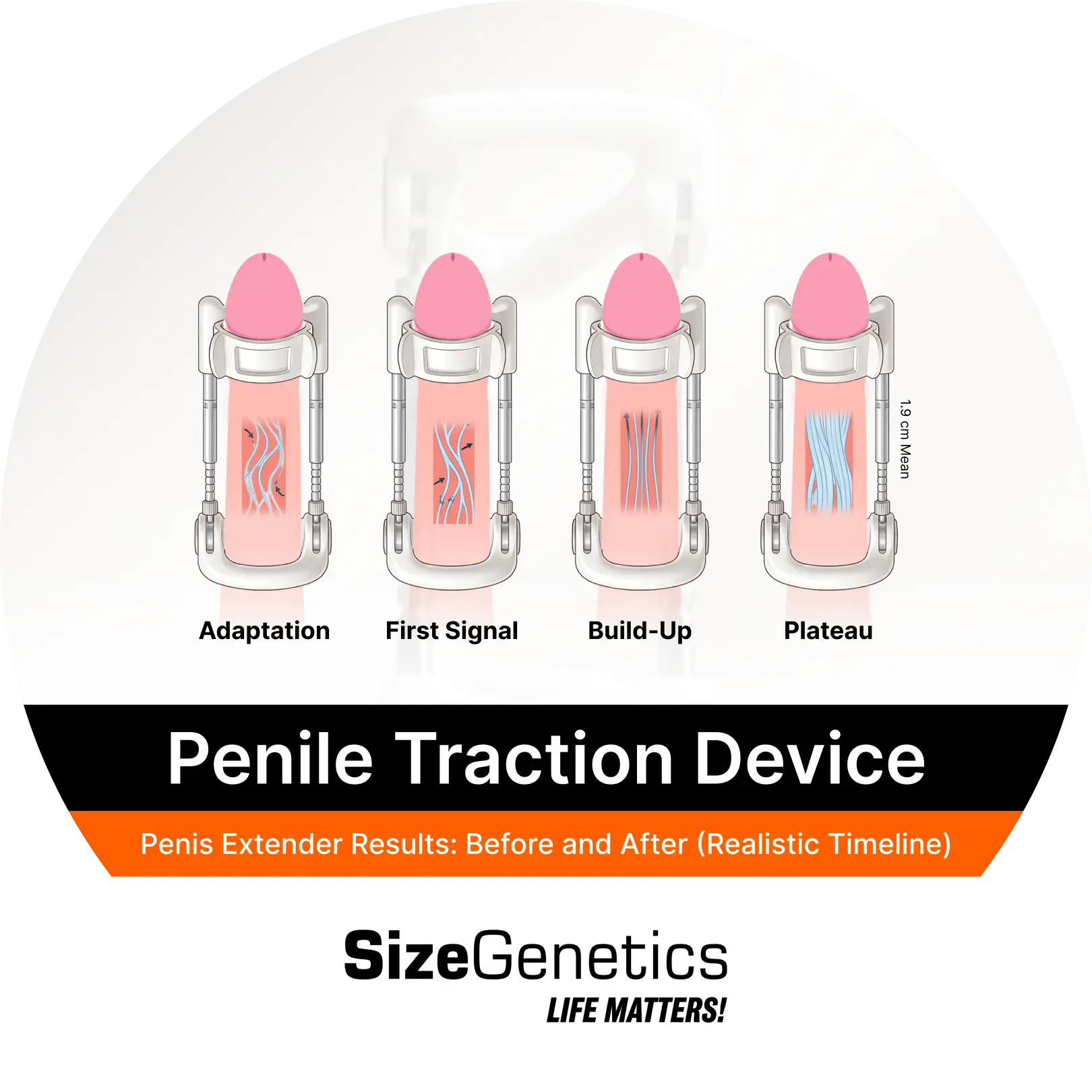 Penis Extender Results: Before and After (Realistic Timeline ...