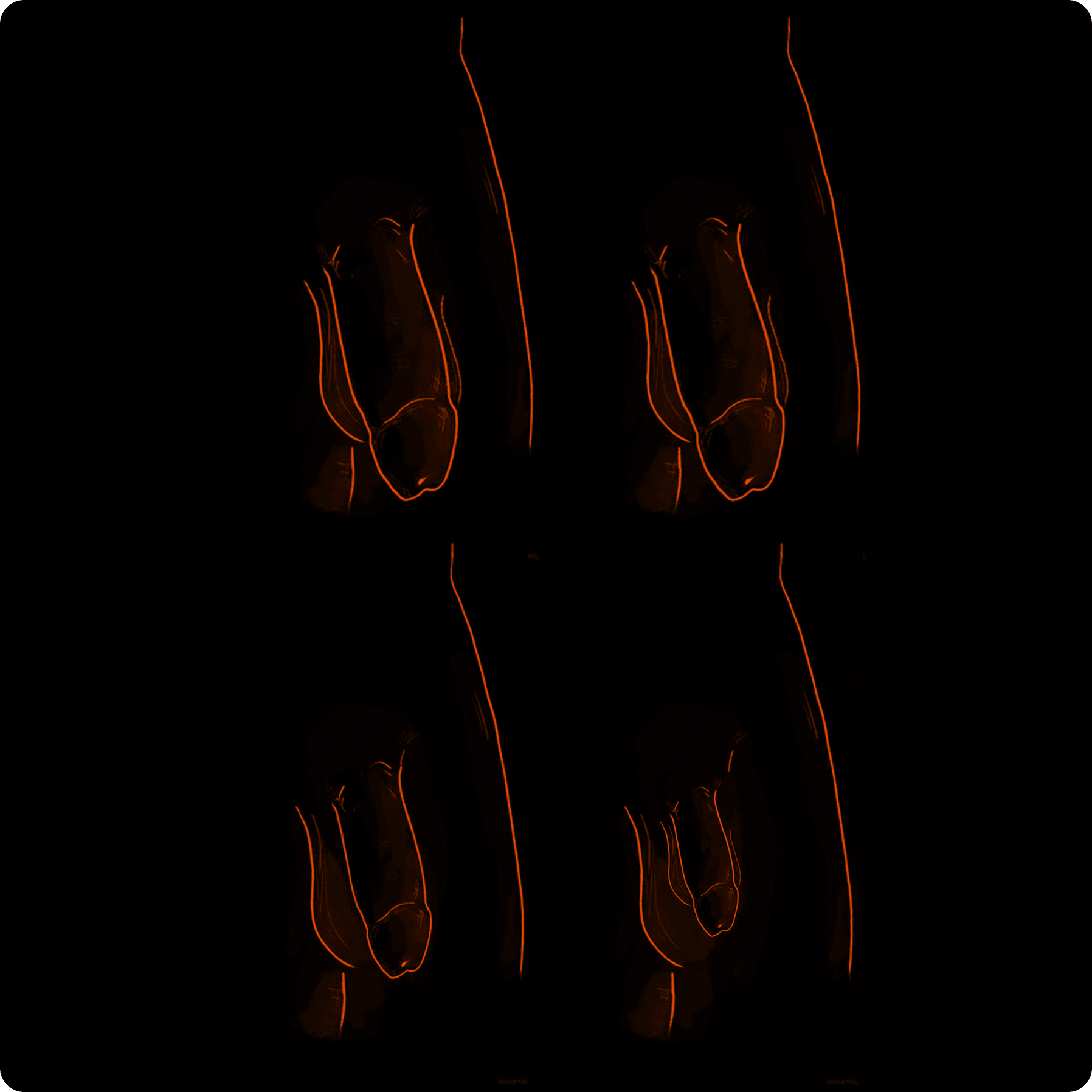 Penile Traction Therapy Results & Expected Outcomes