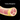 Tunica Albuginea: The Key Structure in Traction Therapy