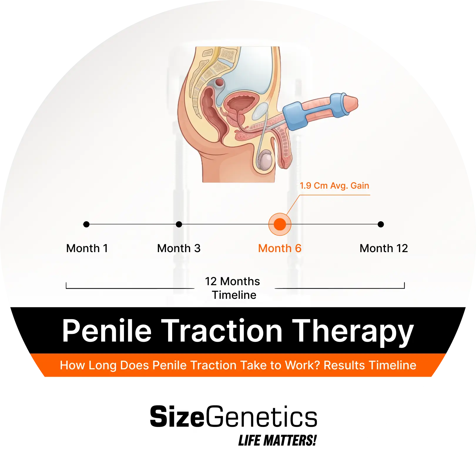 How Long Does Penile Traction Take to Work? Results Timeline