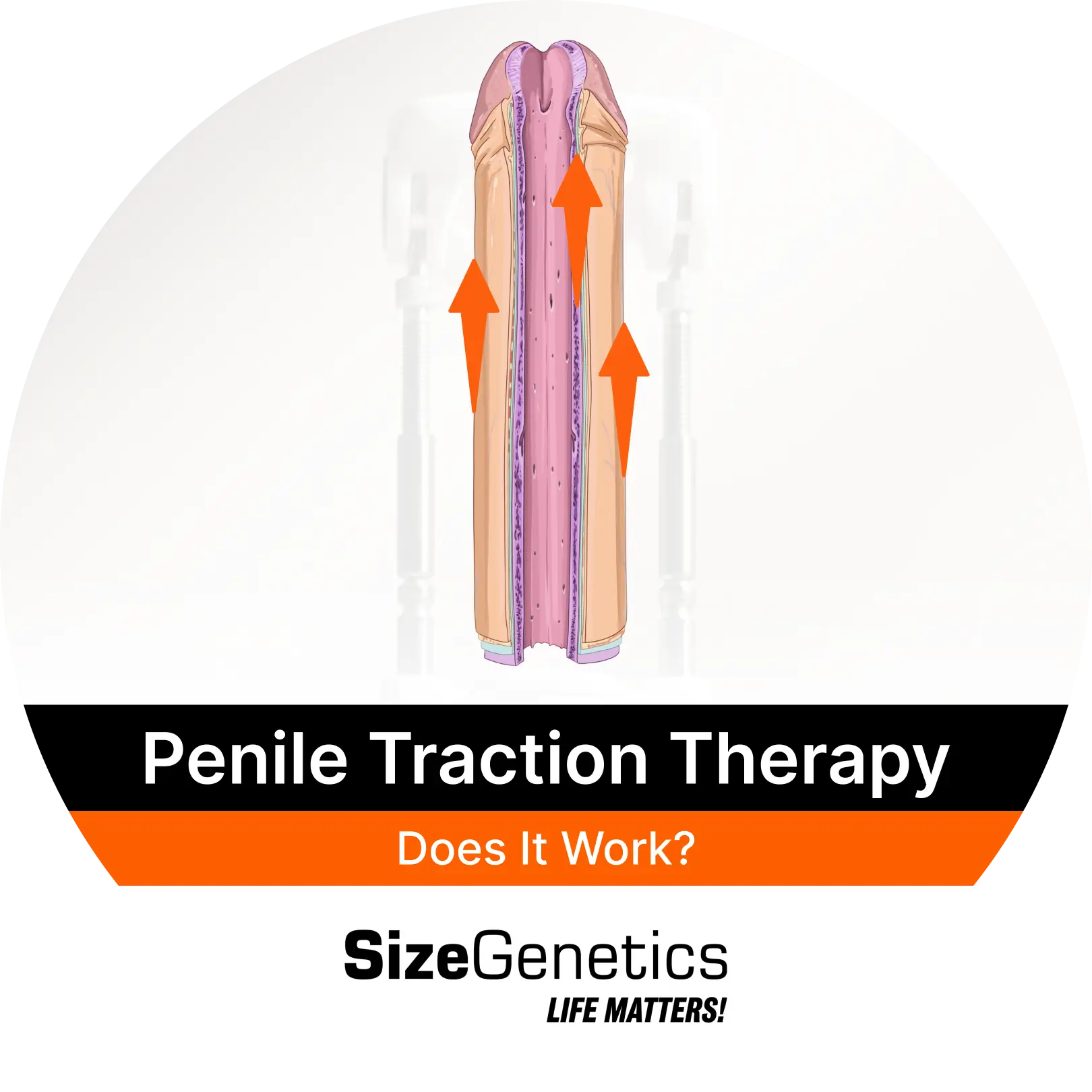 Penile Traction for Length: Does It Work?