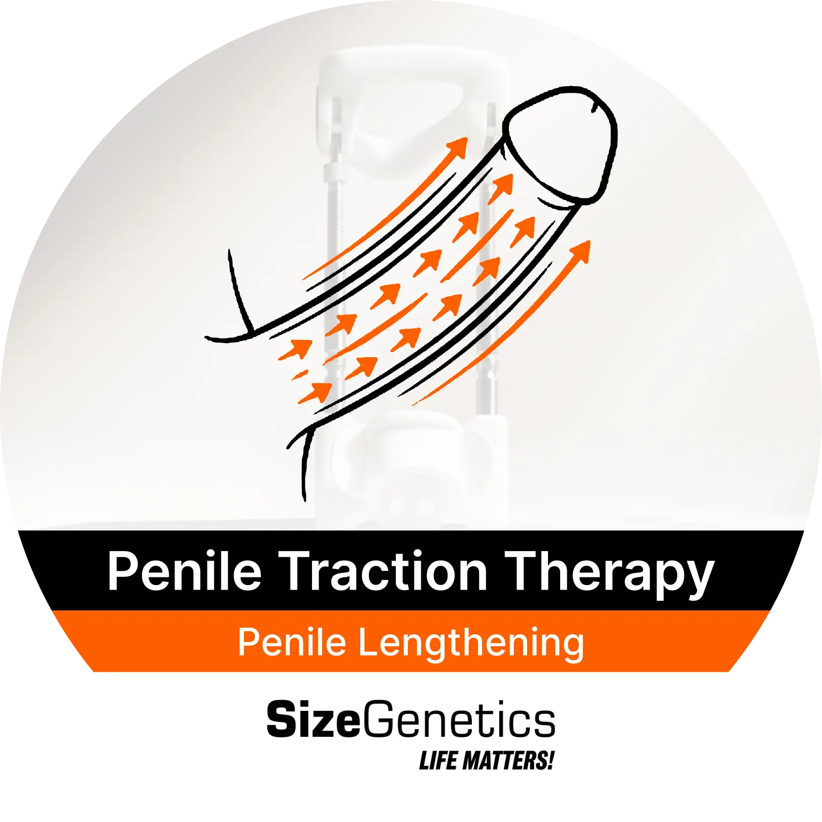 Penile Traction for Penile Lengthening