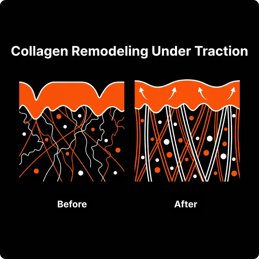 Collagen Remodeling Under Traction